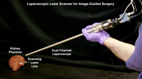 Laparoscopic Laser Scanner